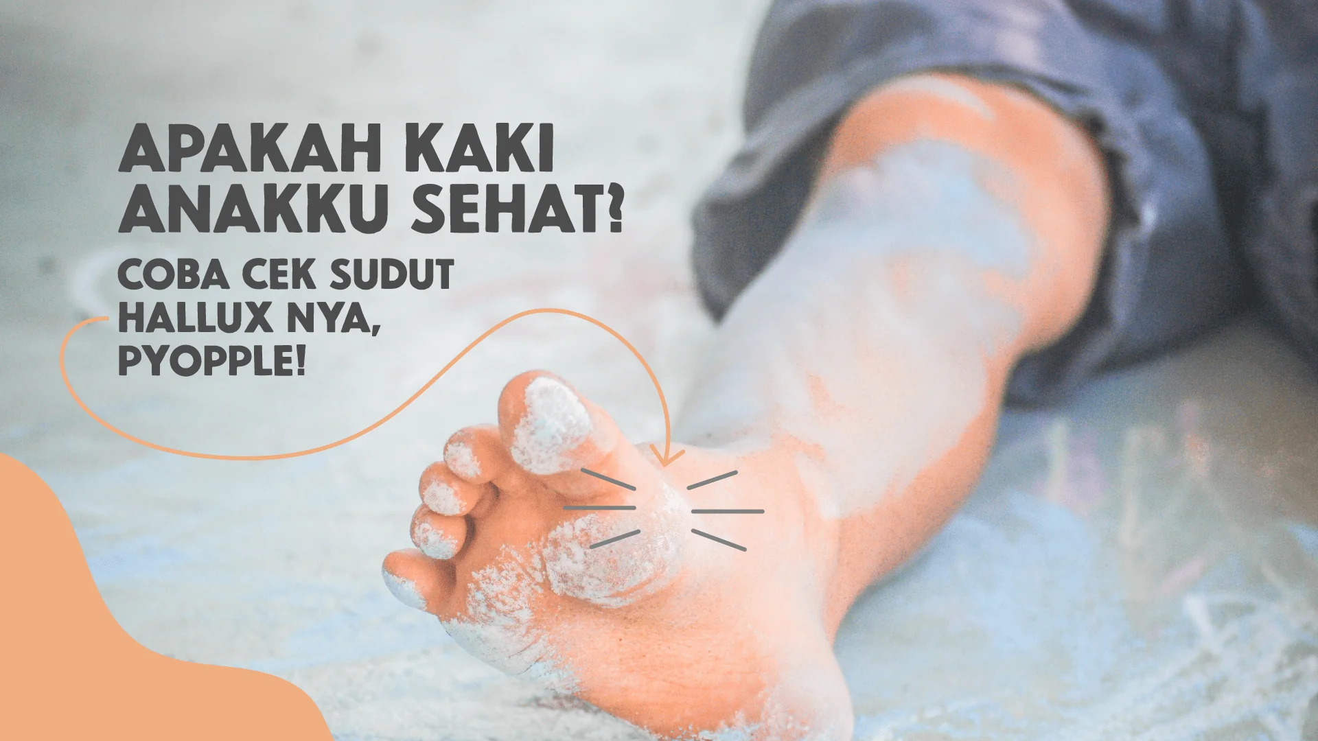 Apakah Bentuk Jempol Kaki Anak Sudah Ideal? Kenali dan Periksa Sudut Hallux Sejak Dini